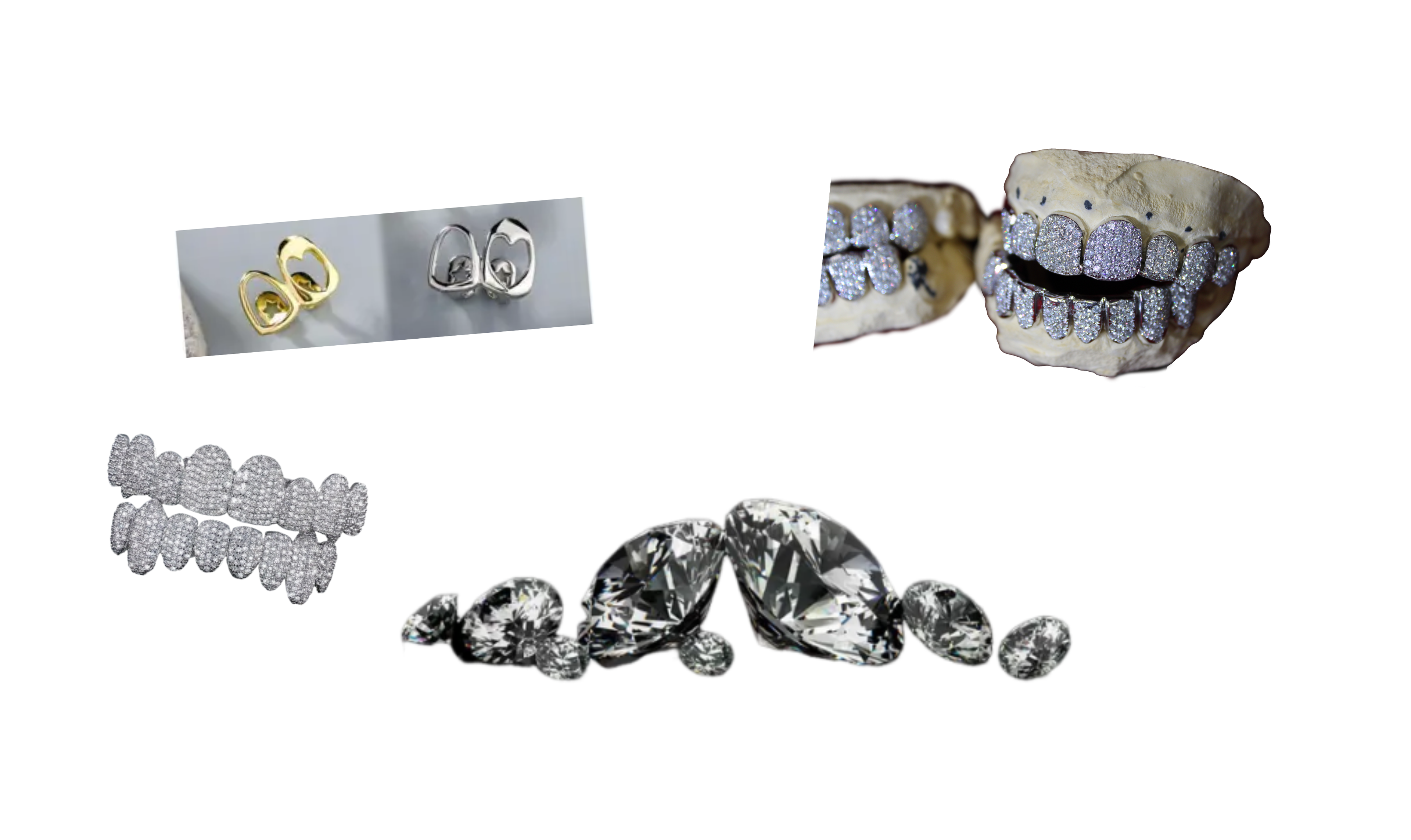 Custom Diamond Grills